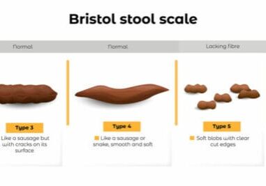 Bristol stool chart showing different stool types.